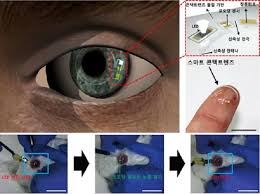 Smart contact lenses 