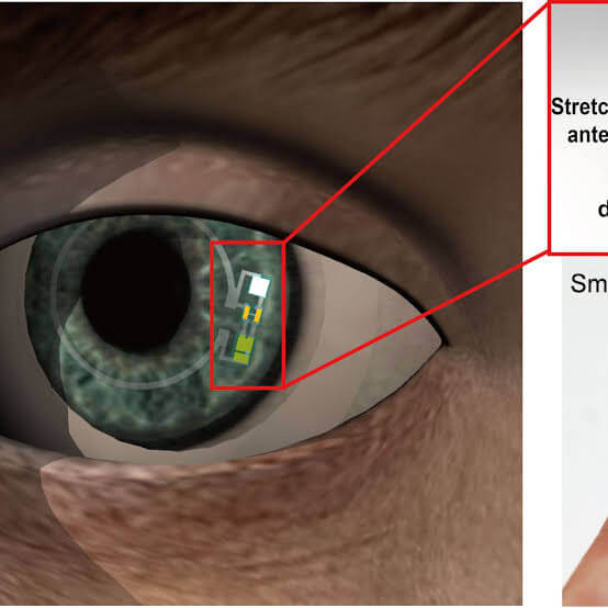 Smart contact lenses