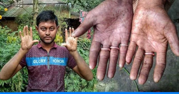 Apu Sarkar family doesn’t have fingerprints